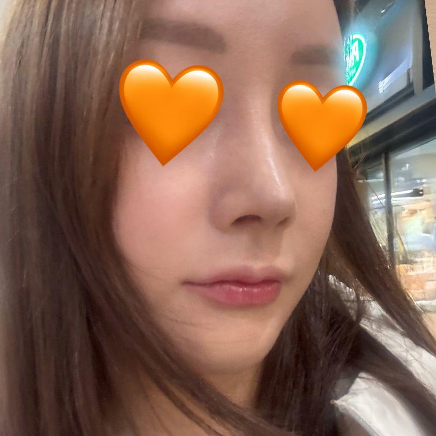 後