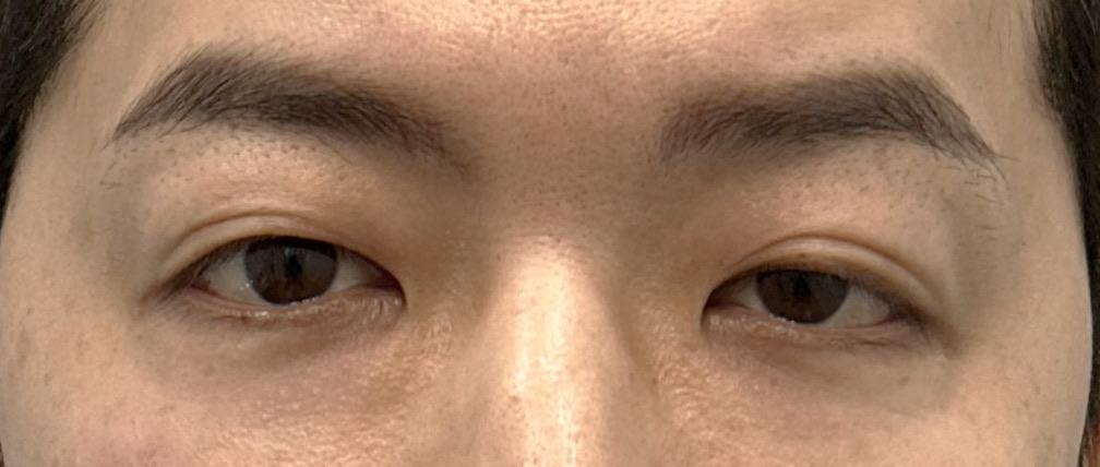 前