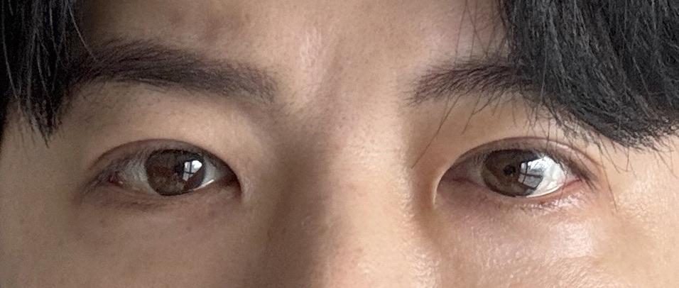后
