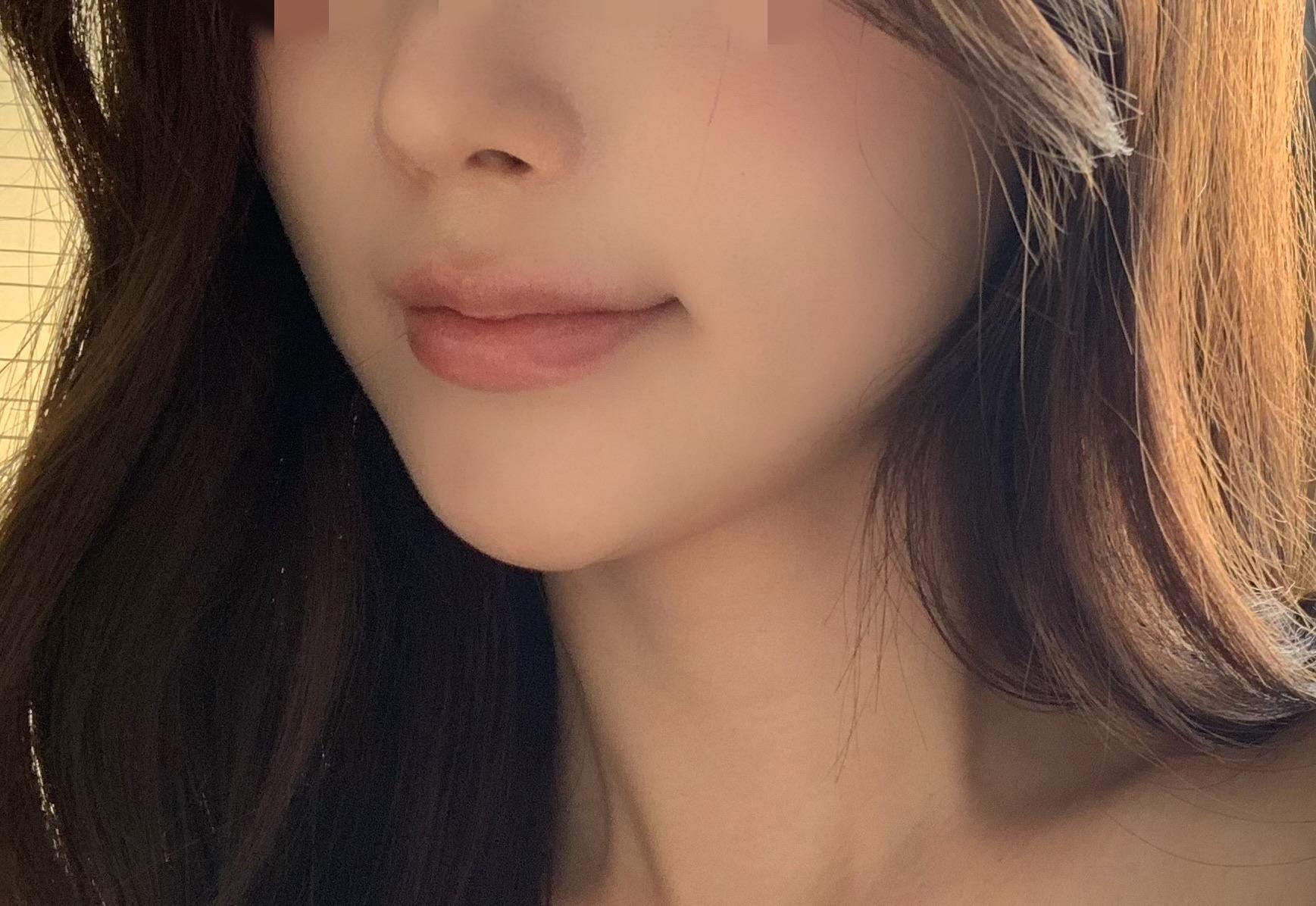 後