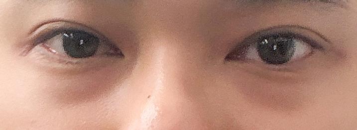 後
