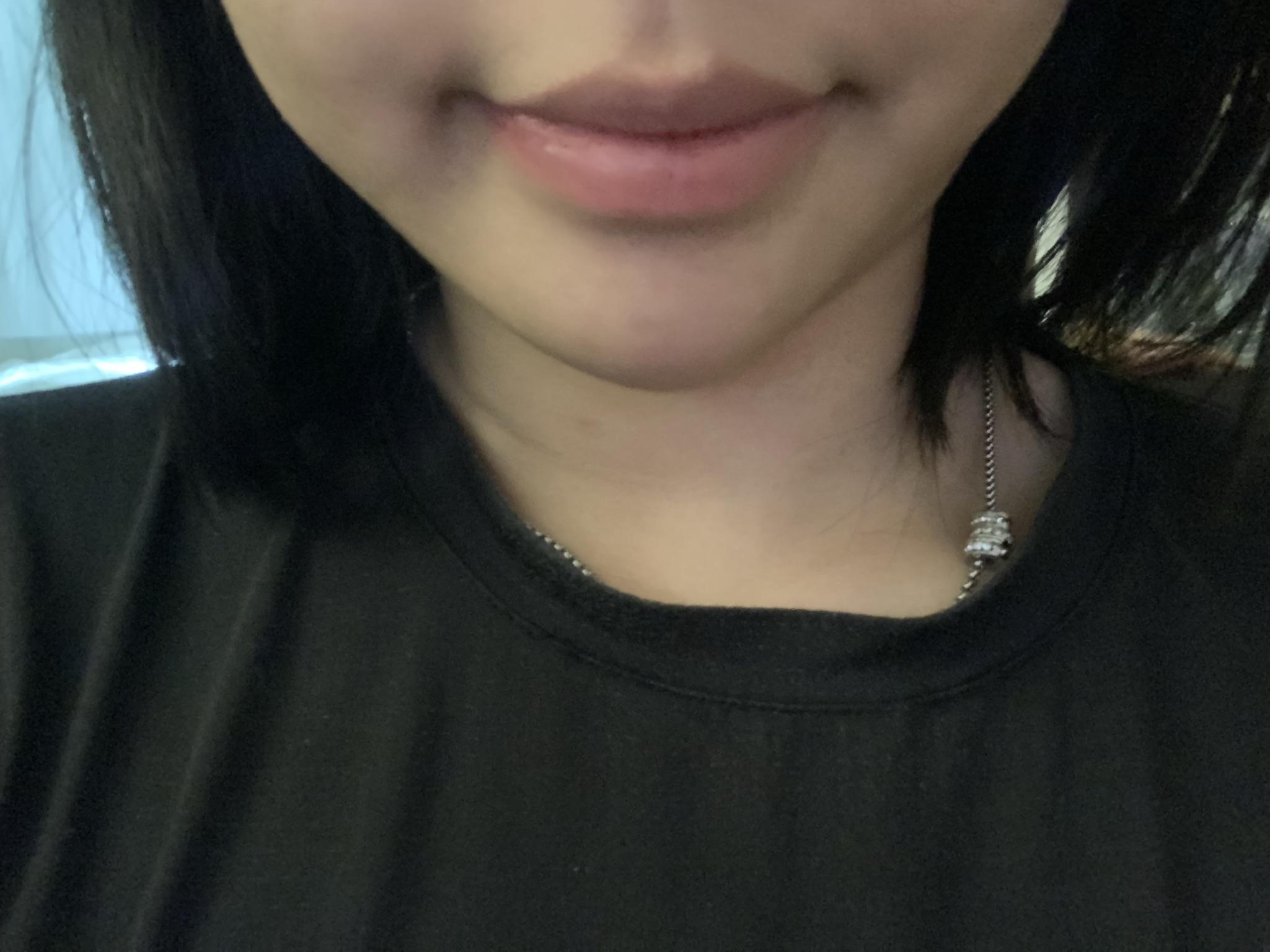 後