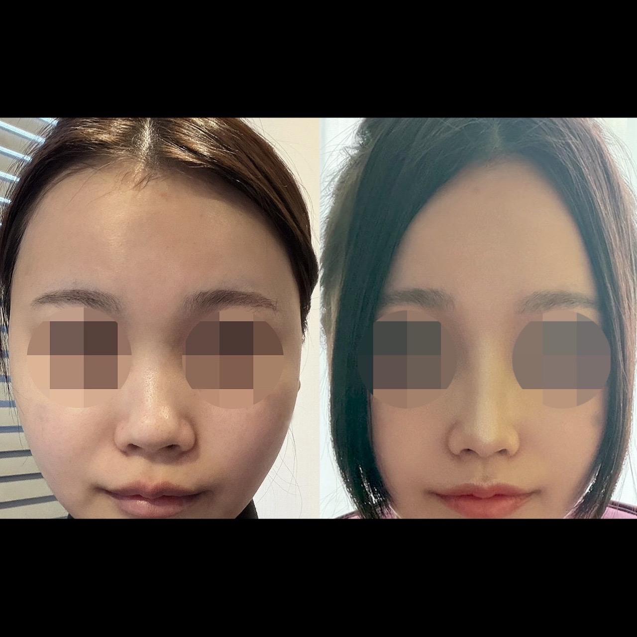 後