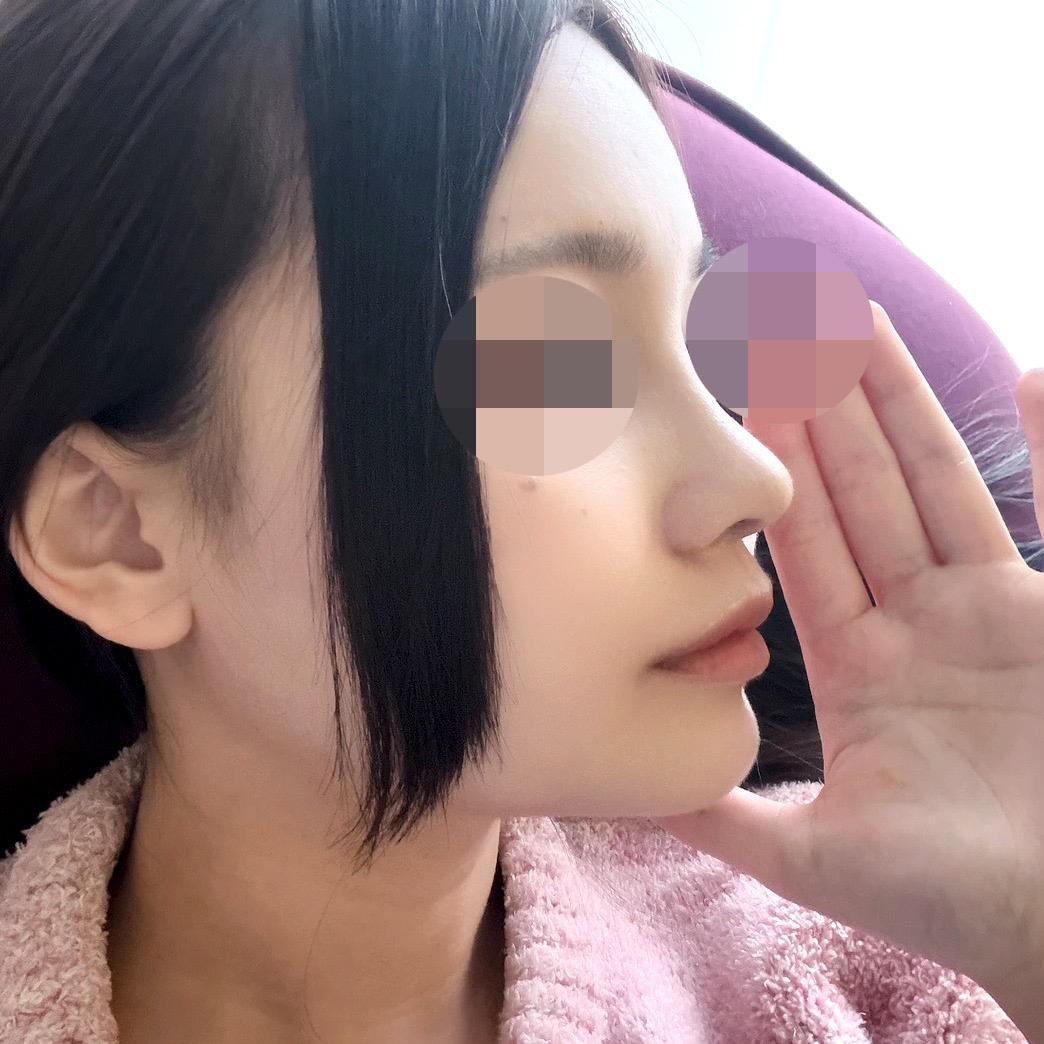 後