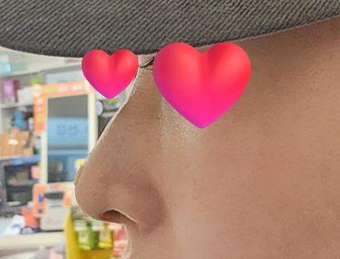 後