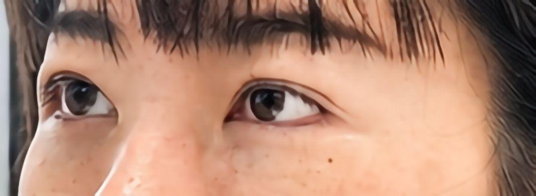 後