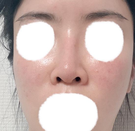 後
