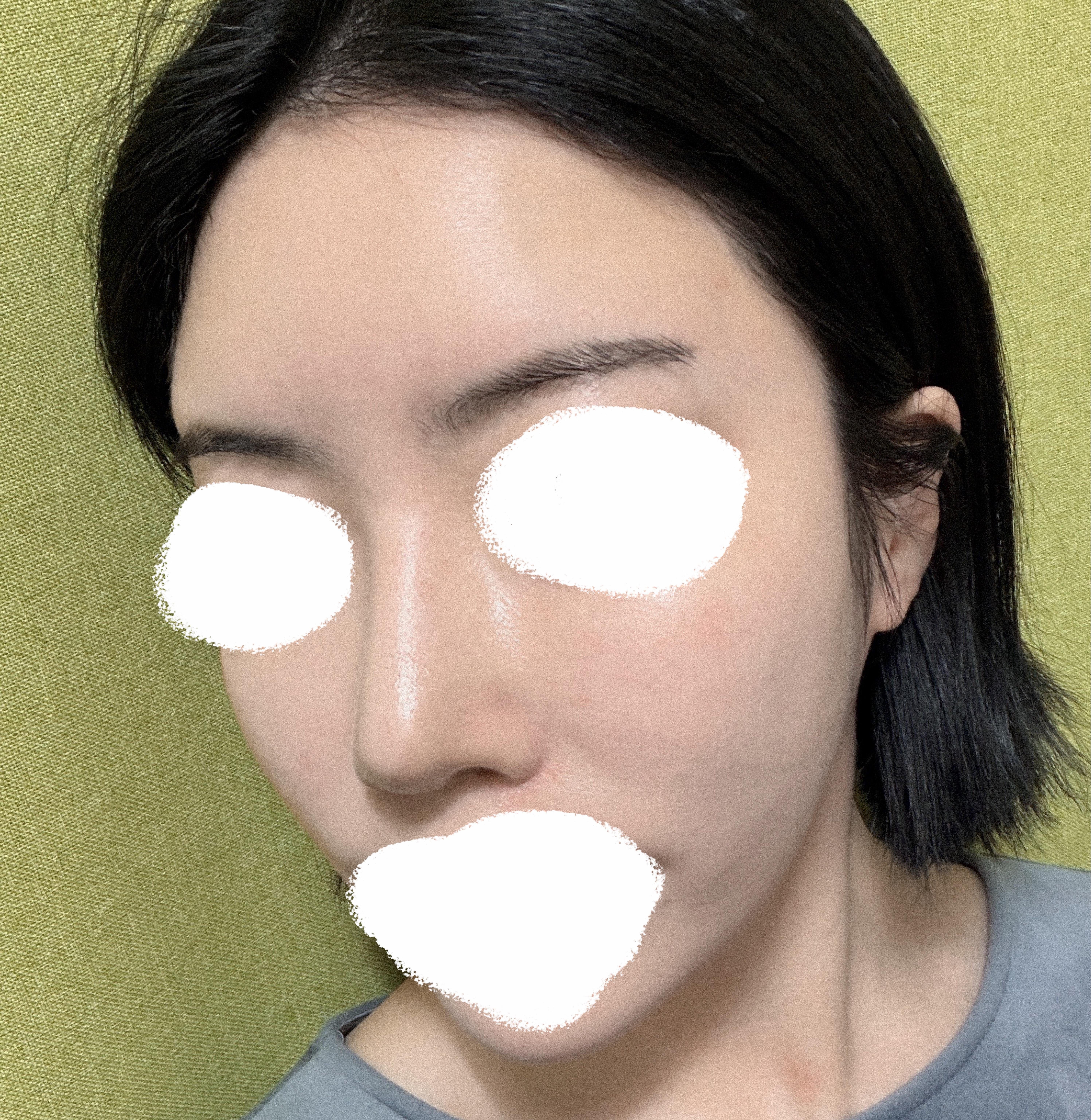 後