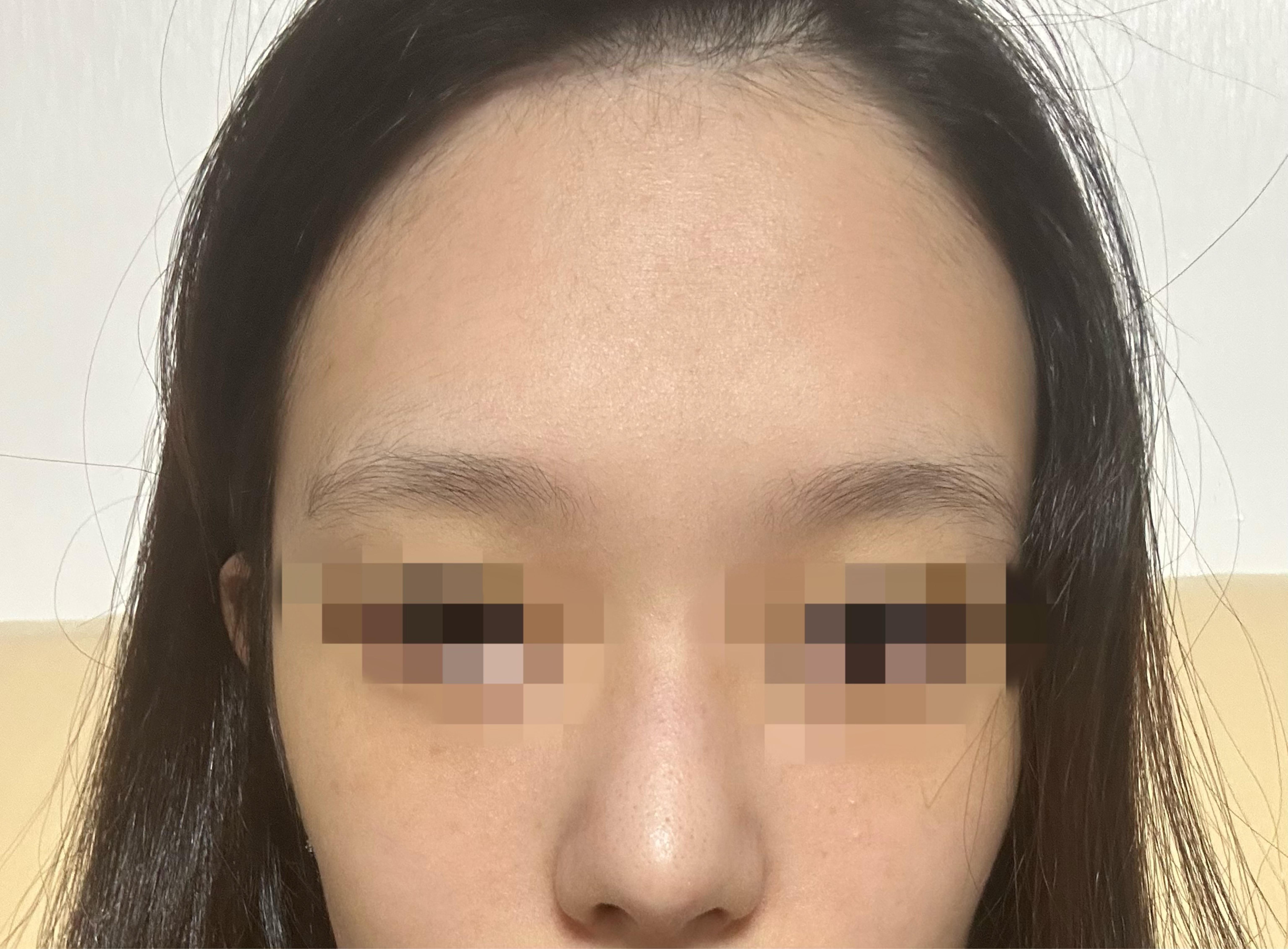 後