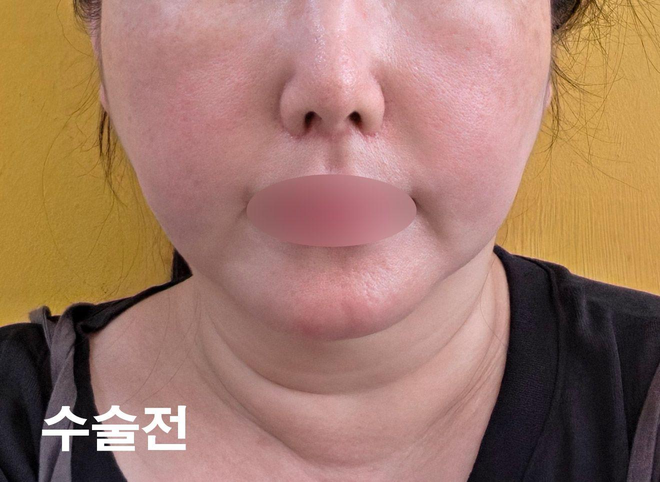 後