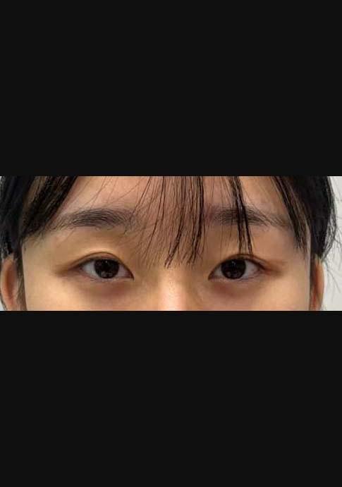 後