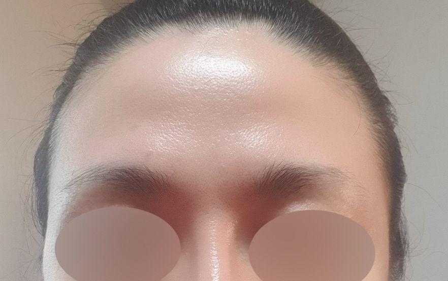 后
