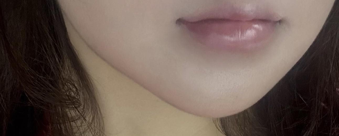 後