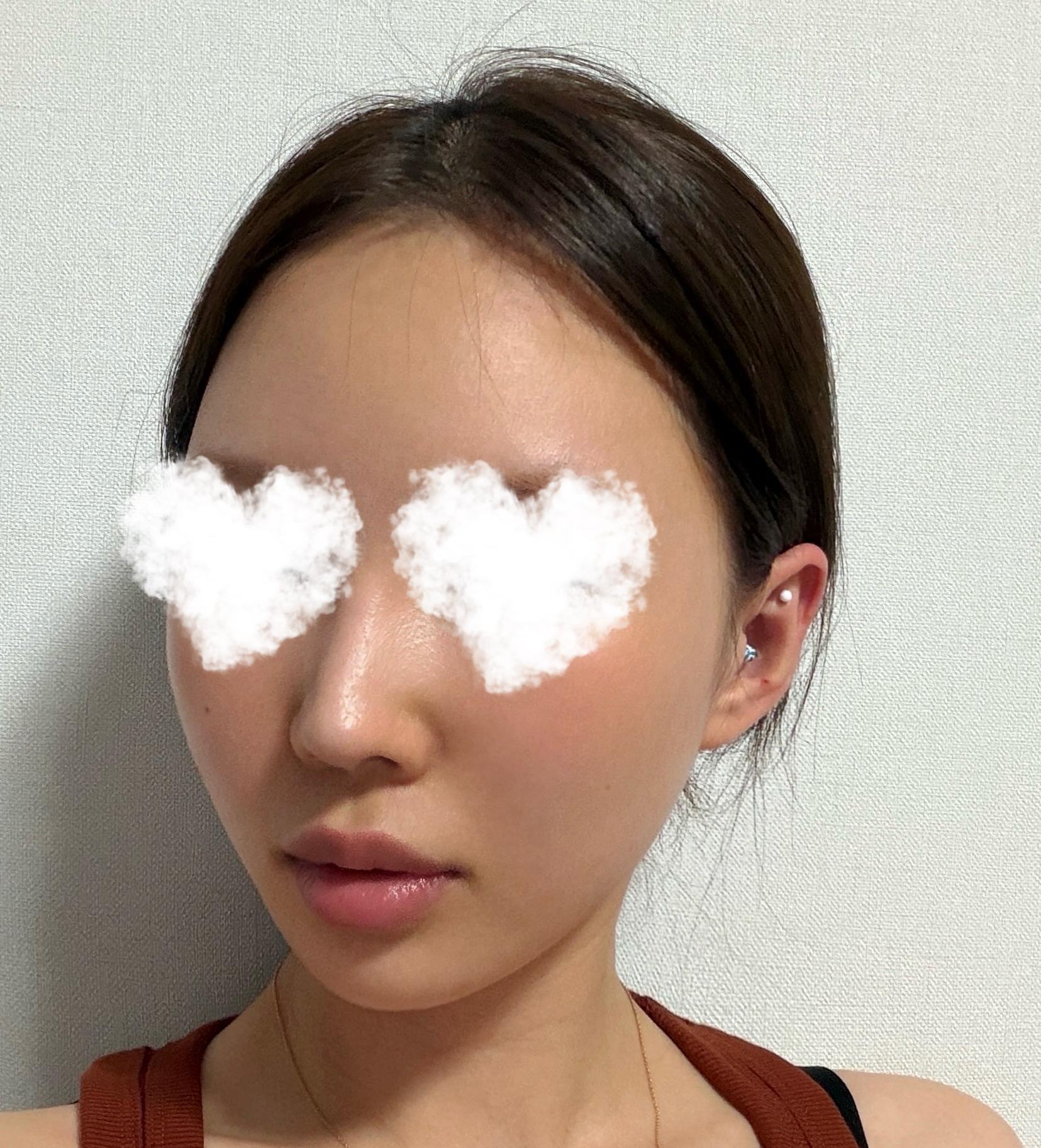 后