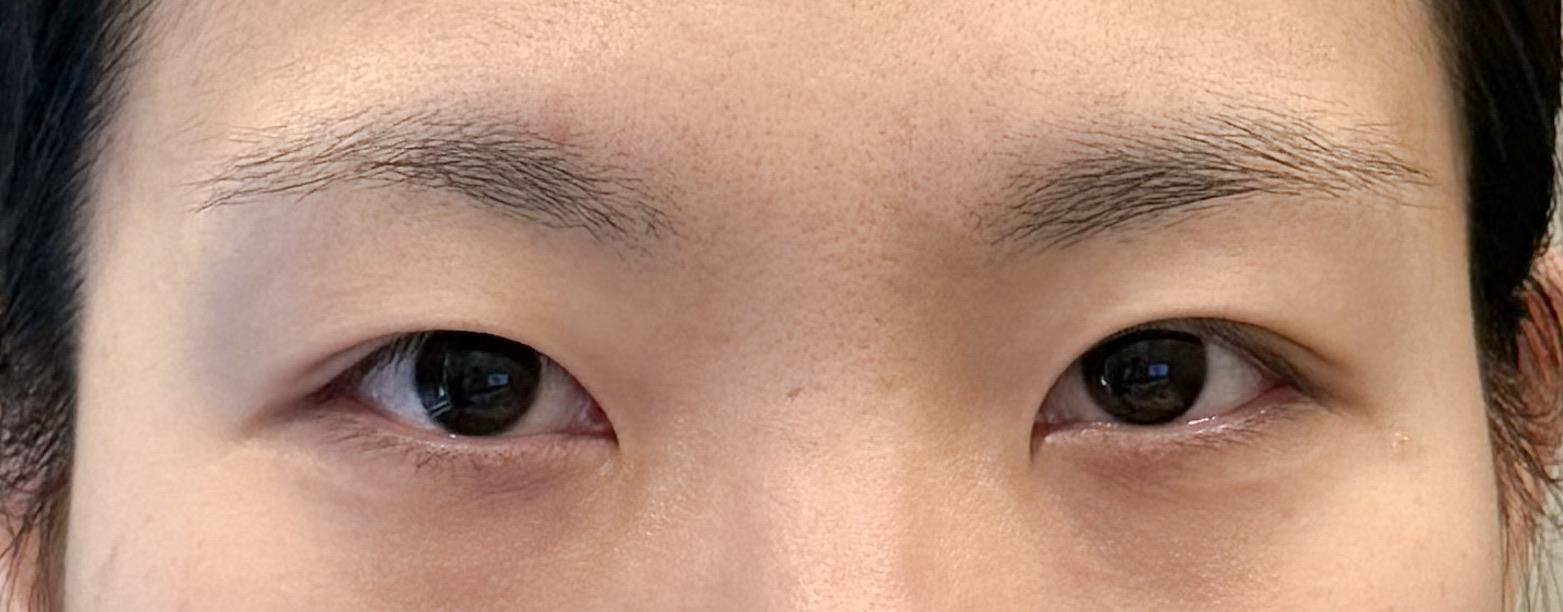 後
