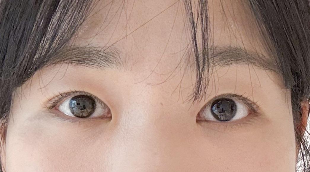 後