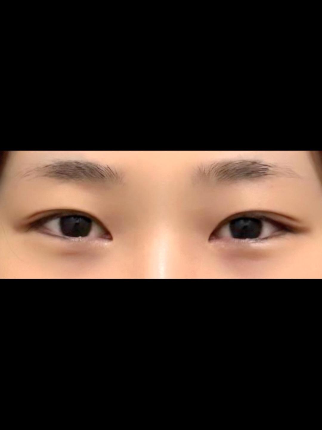 後