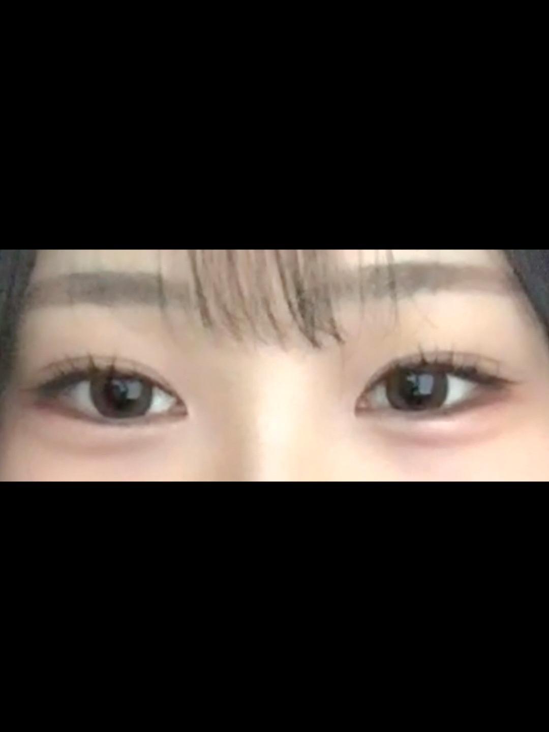 後