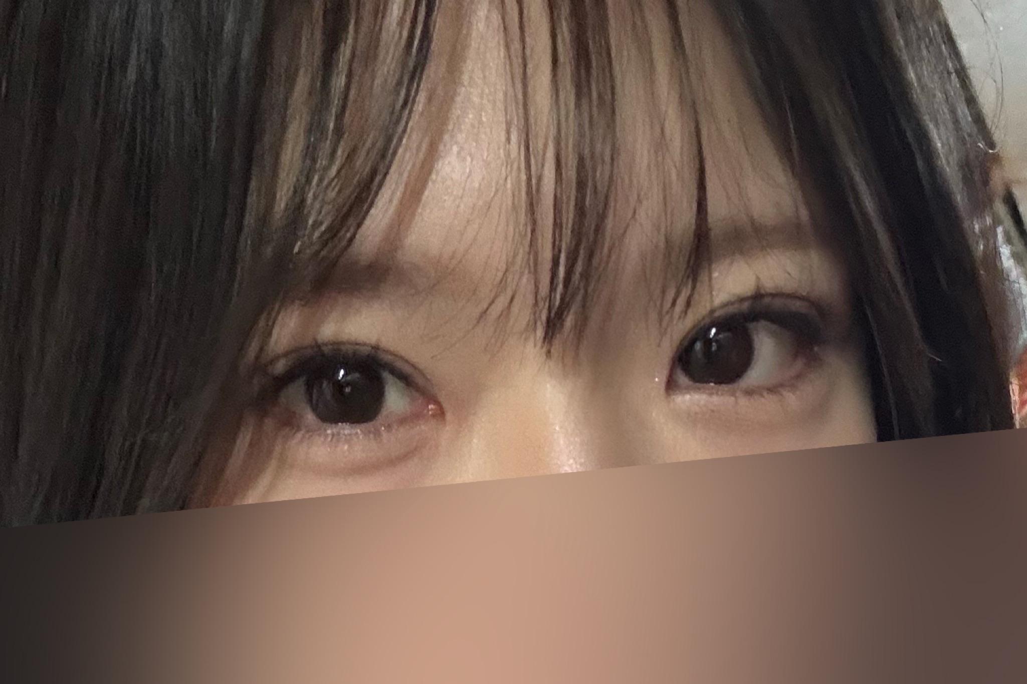 後
