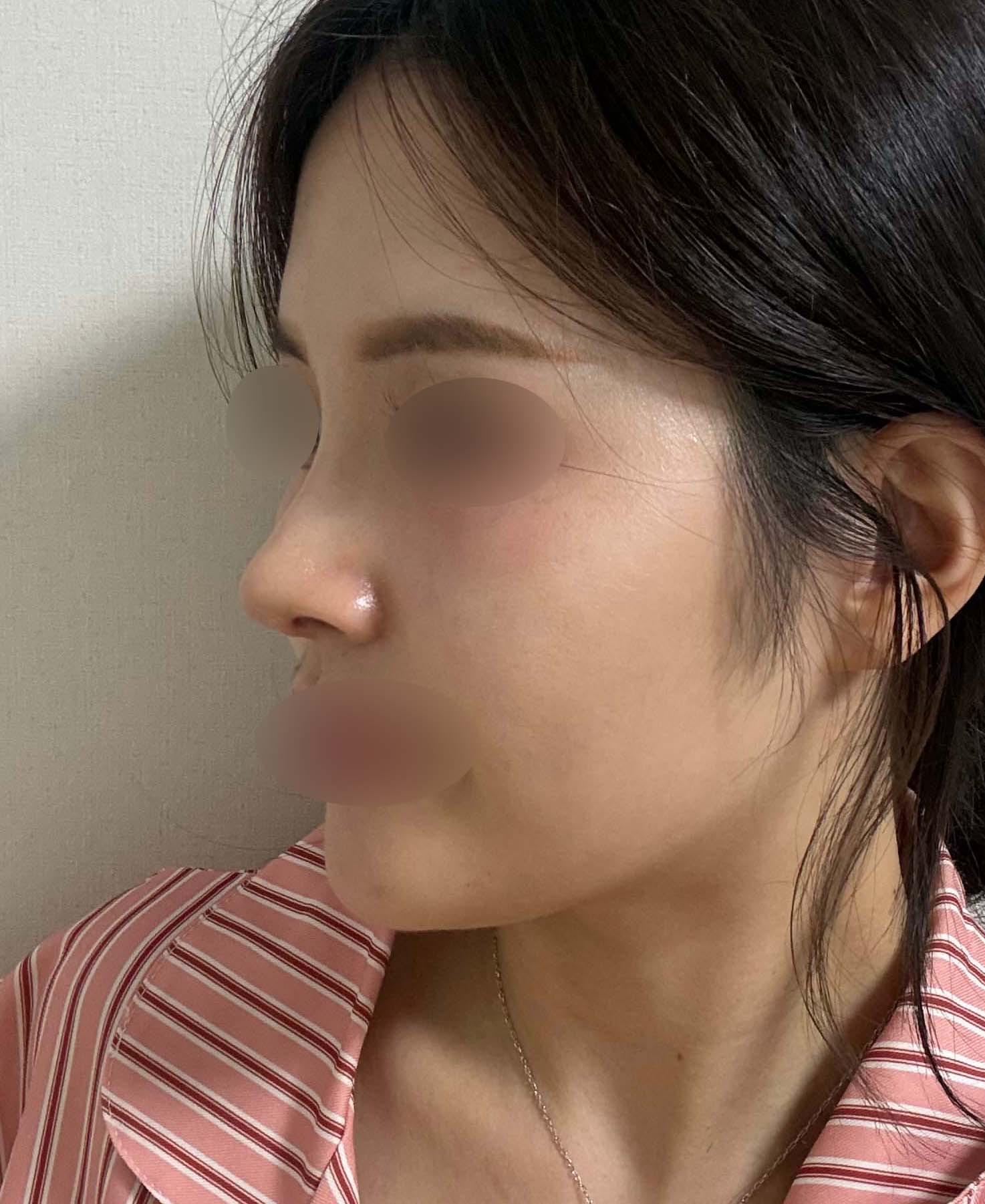 後