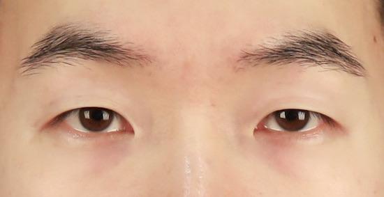 Before