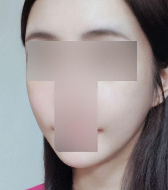 後