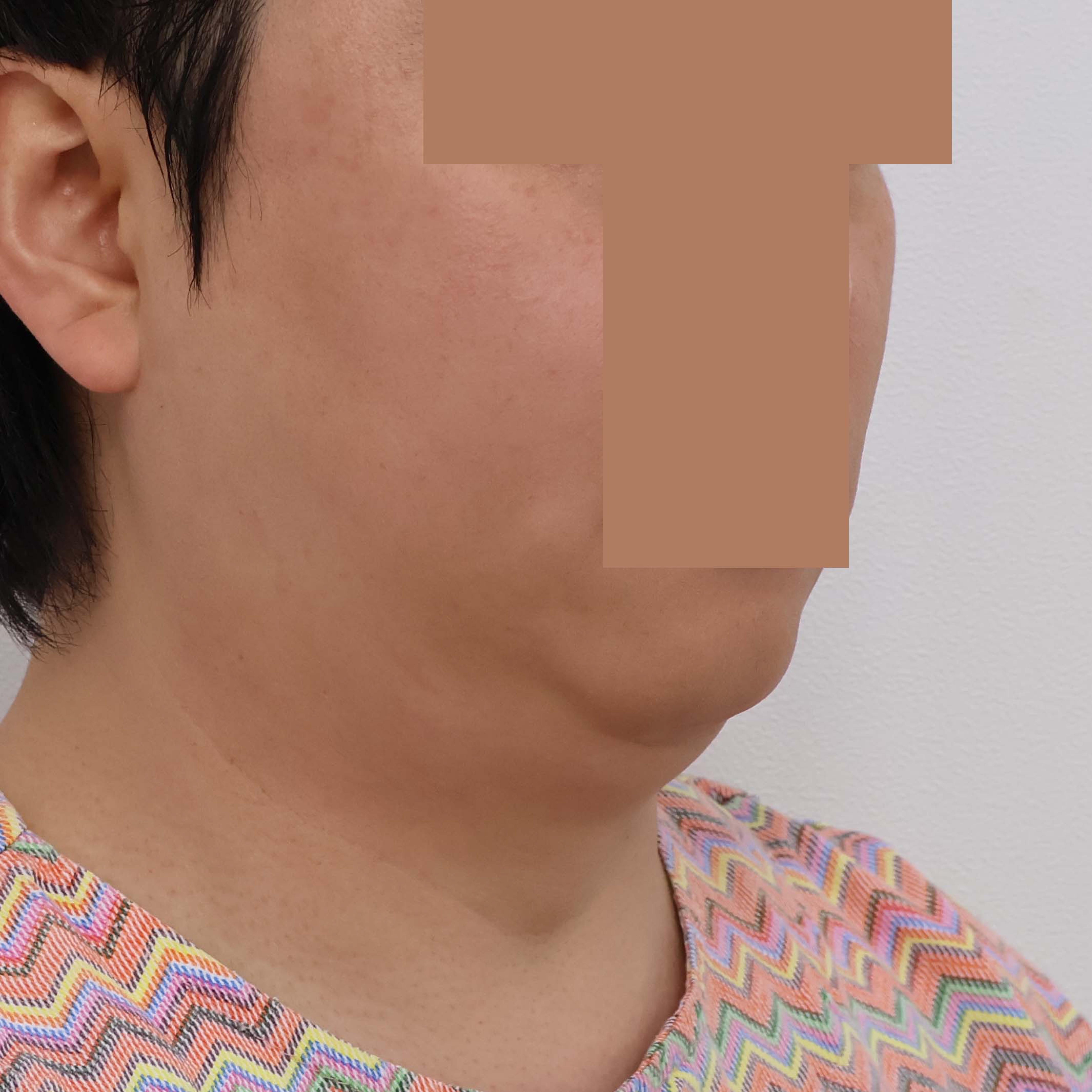 後