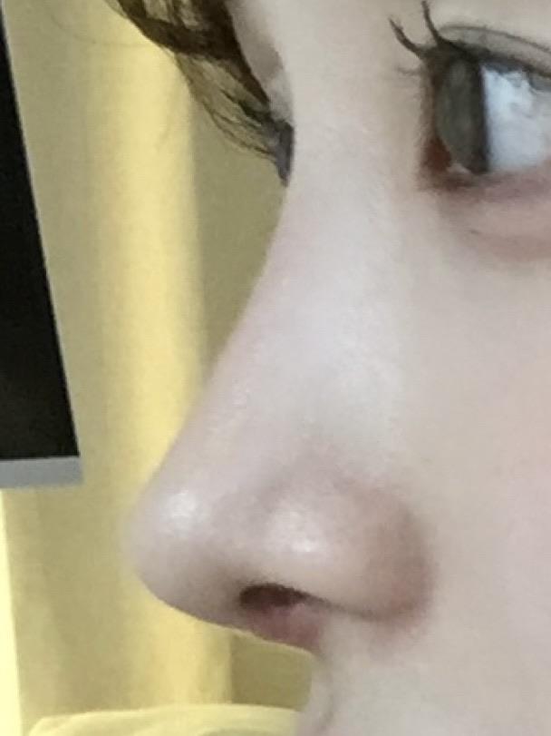 後