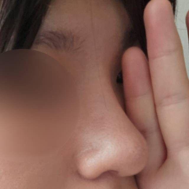 後