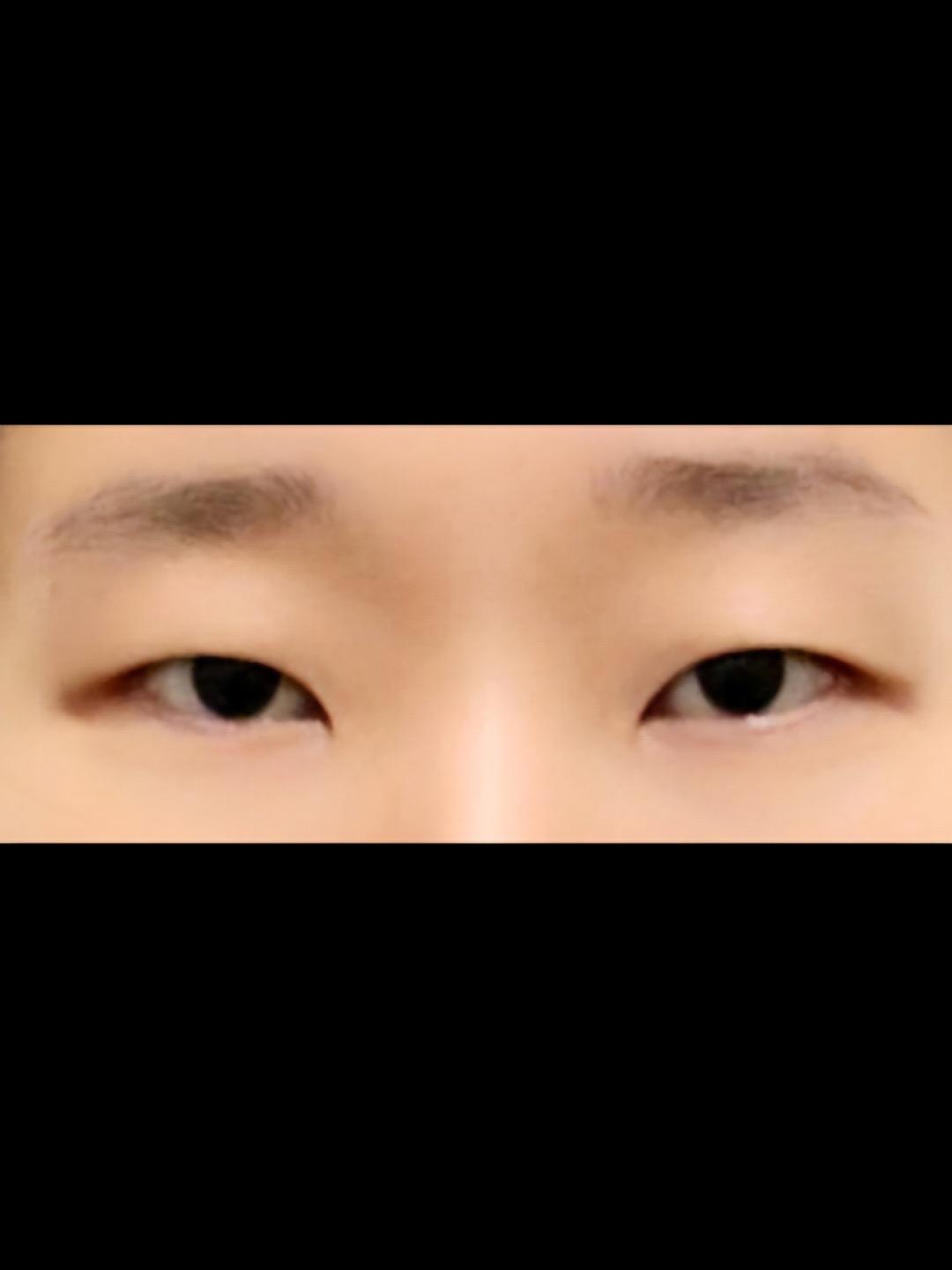 後