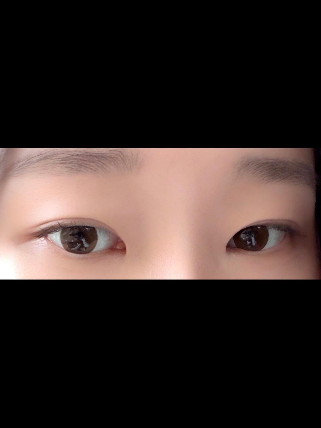 後