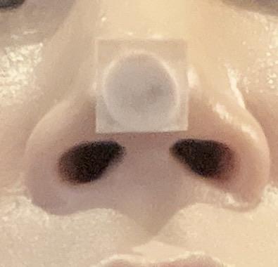 後