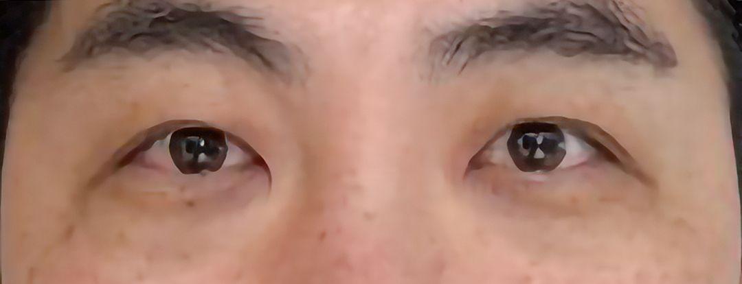 後