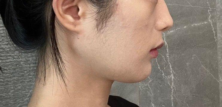 後