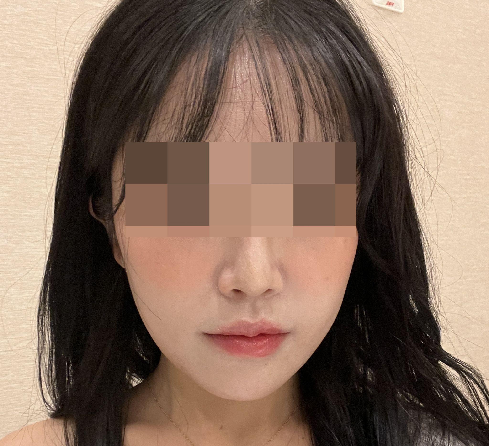 後