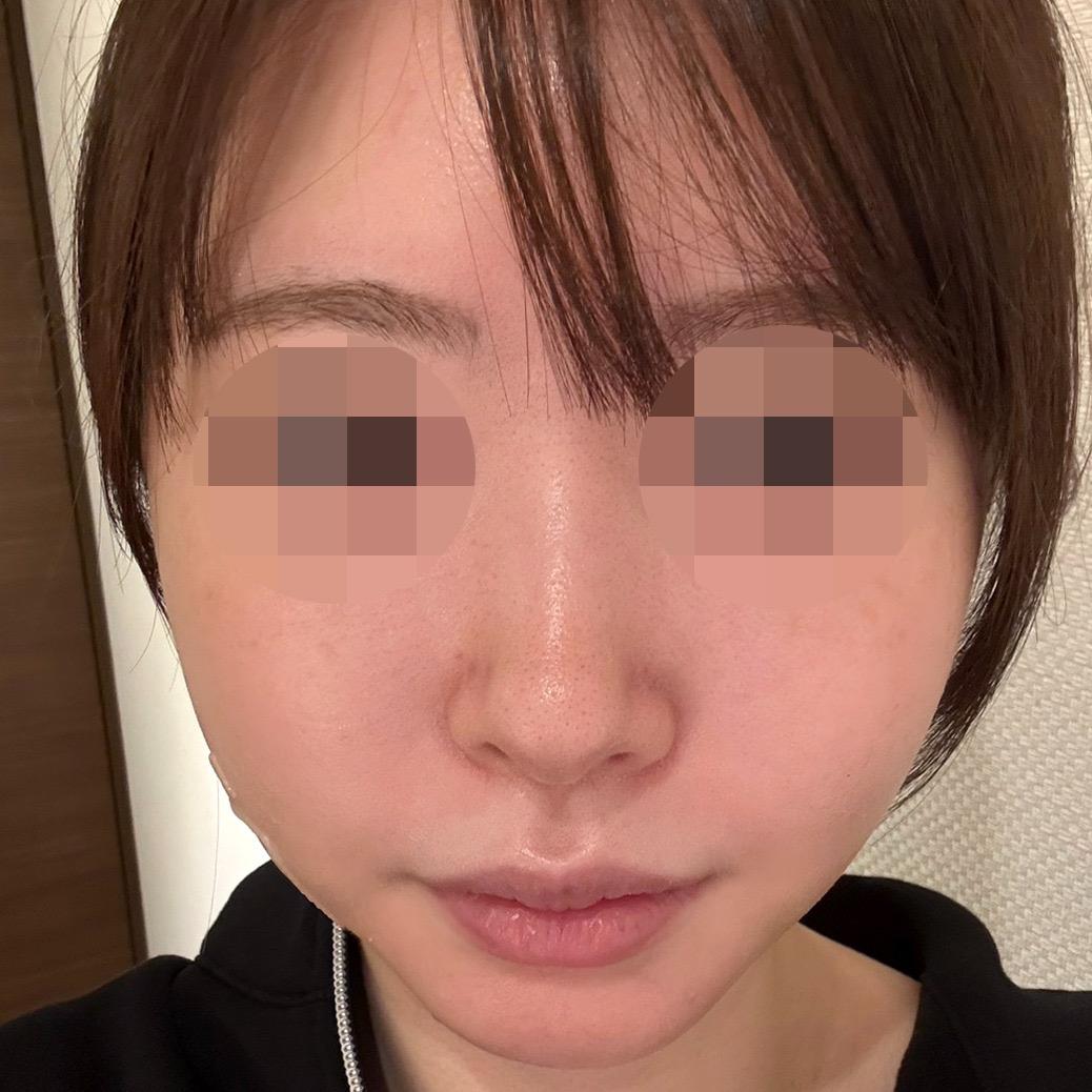 後