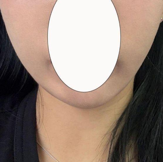 後
