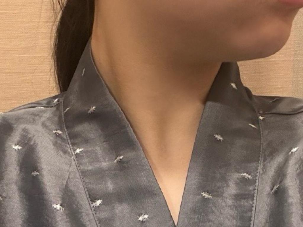 後