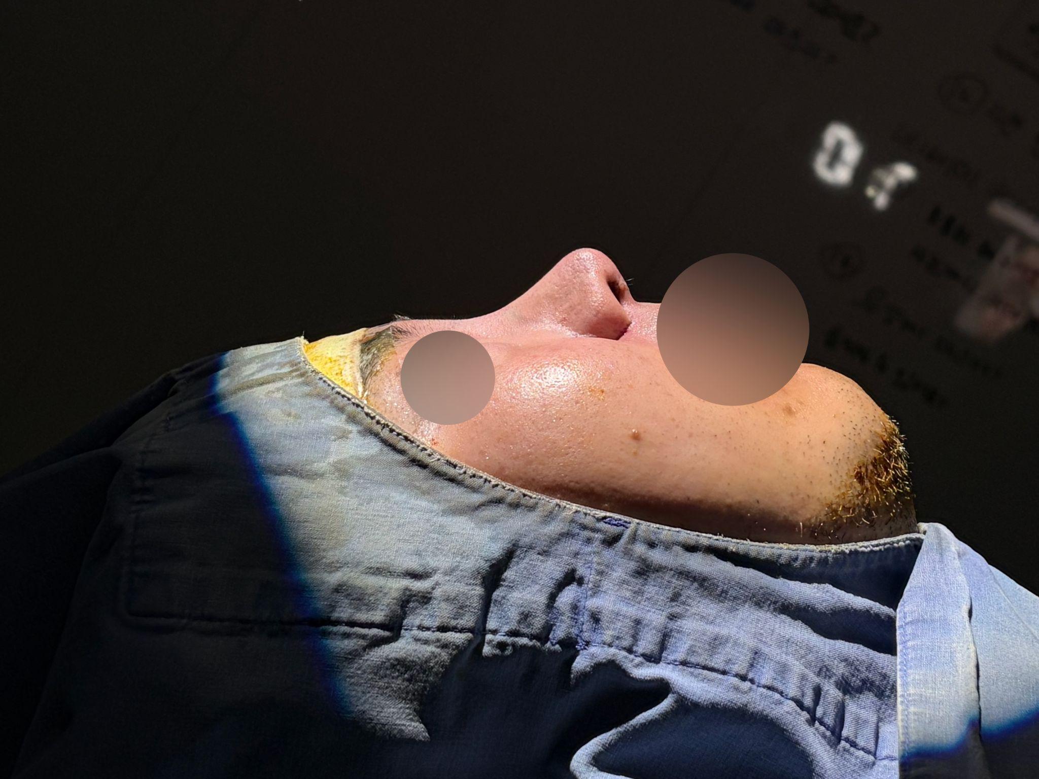 後