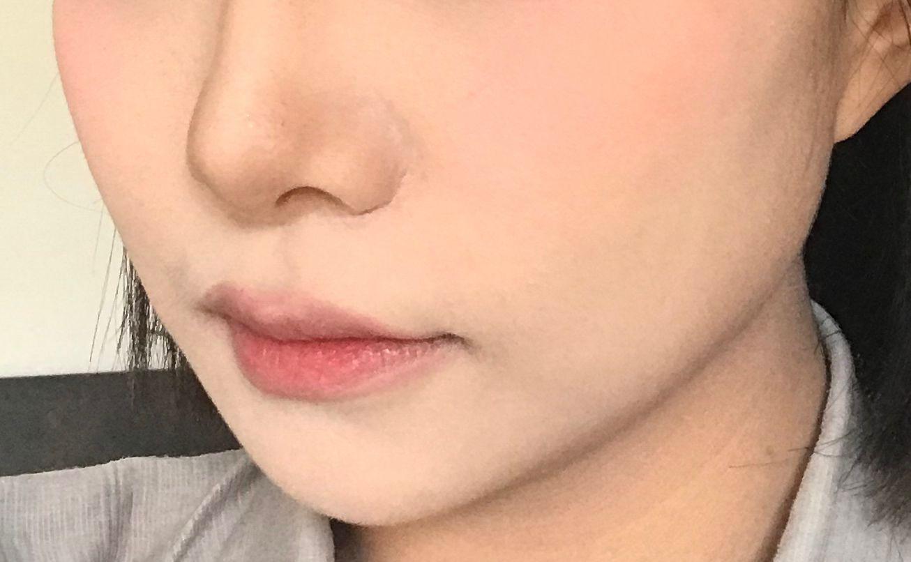 後