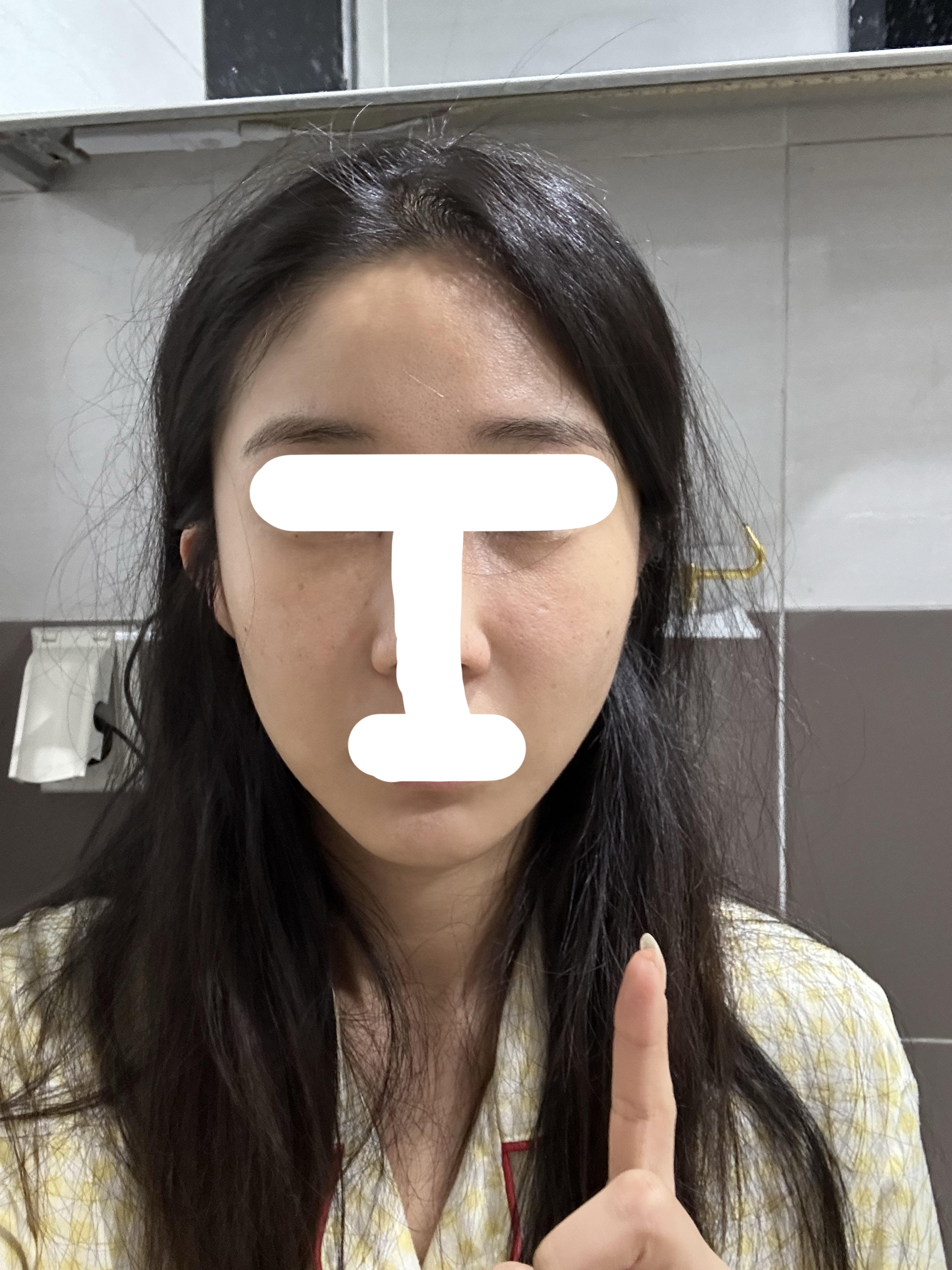 後
