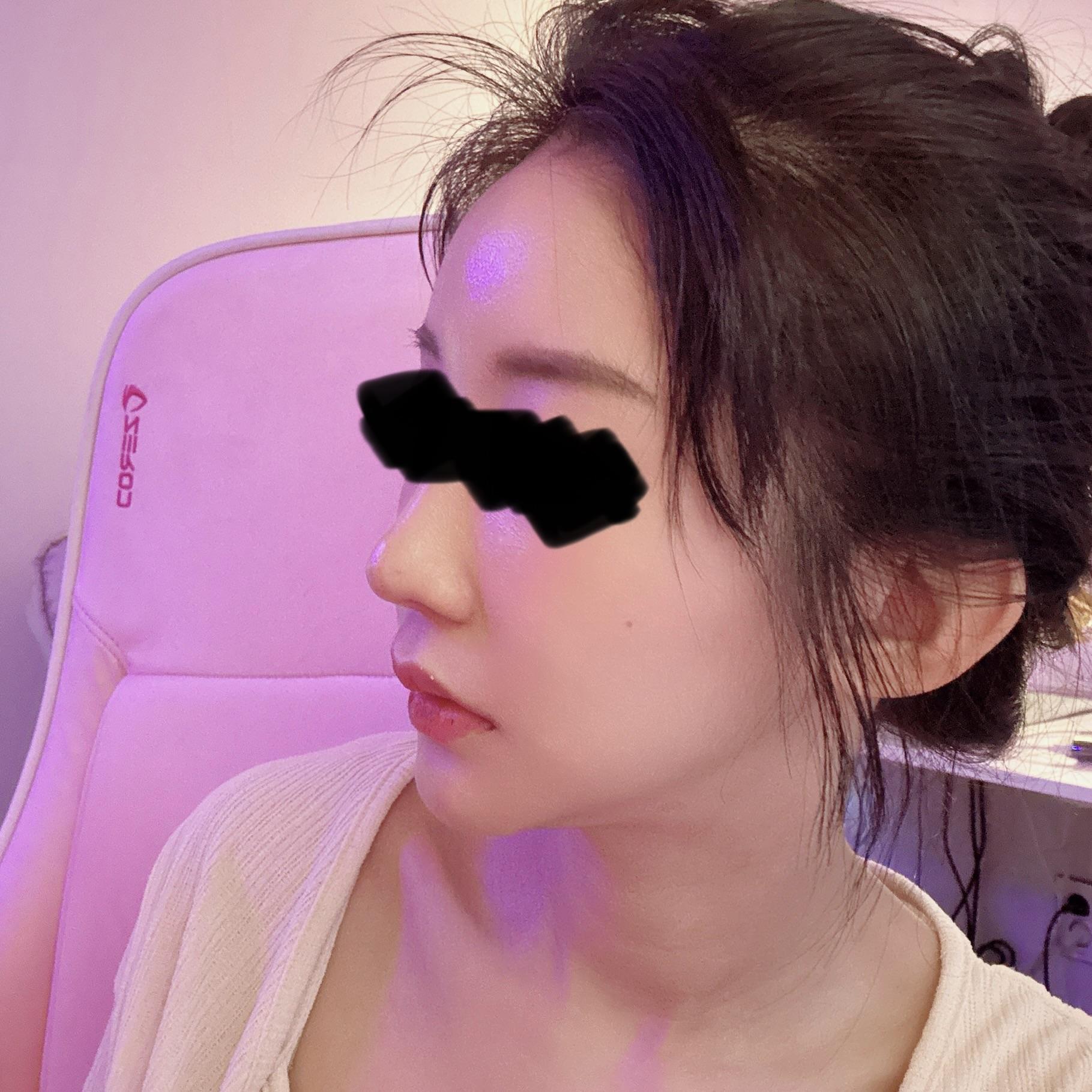 後