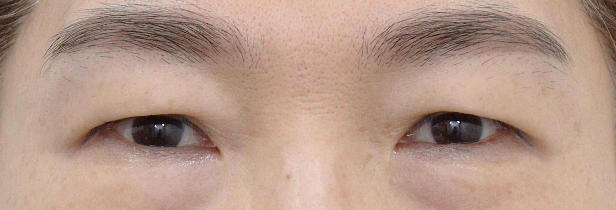 後
