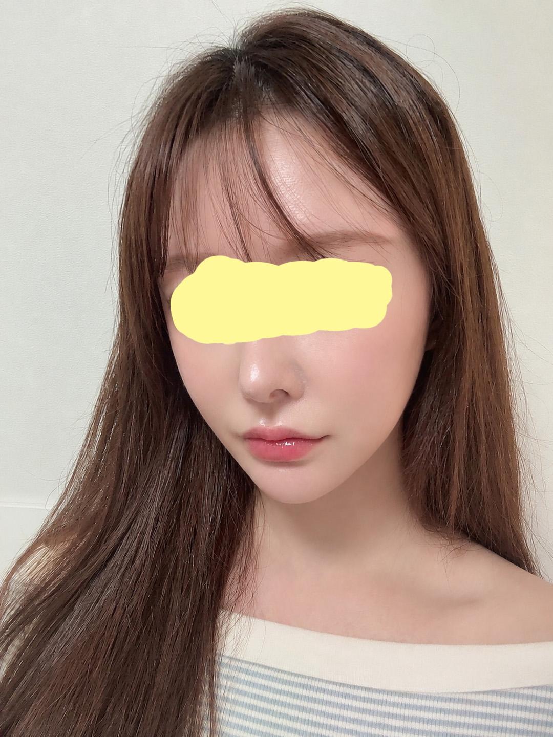 後