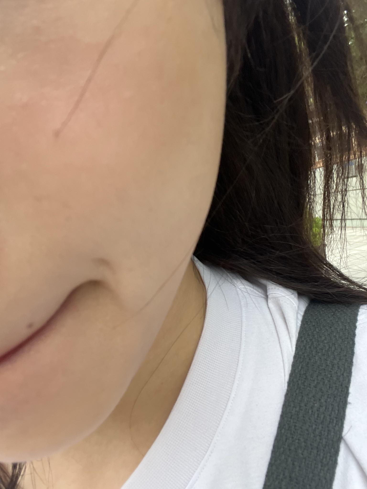 後