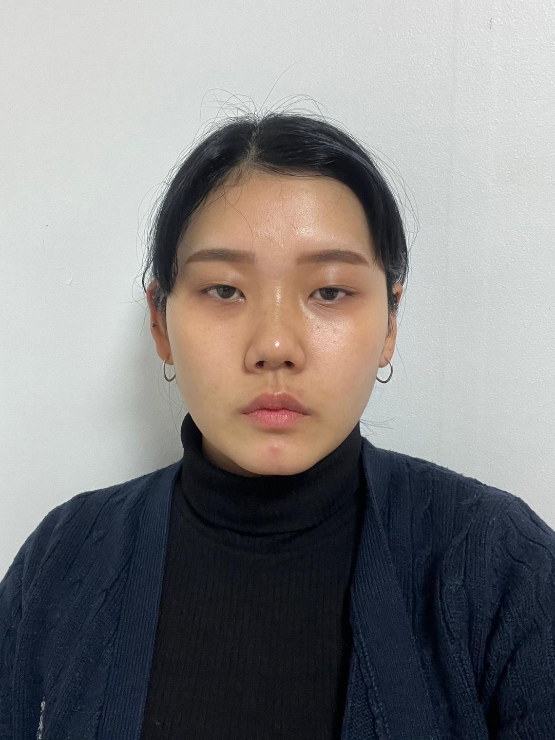 後