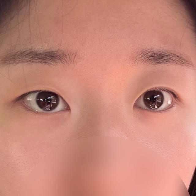 後