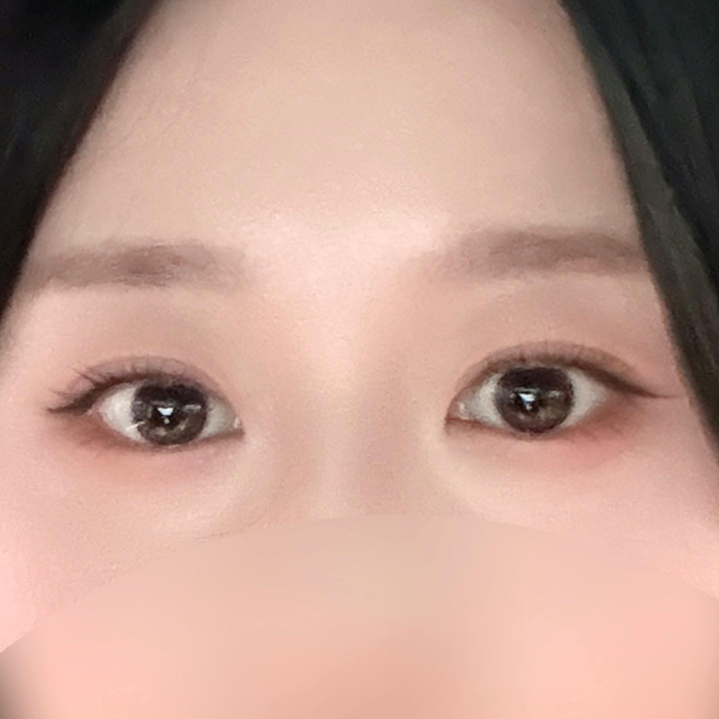 後