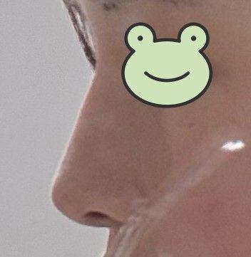 後