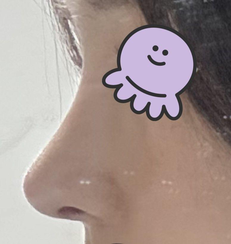 後